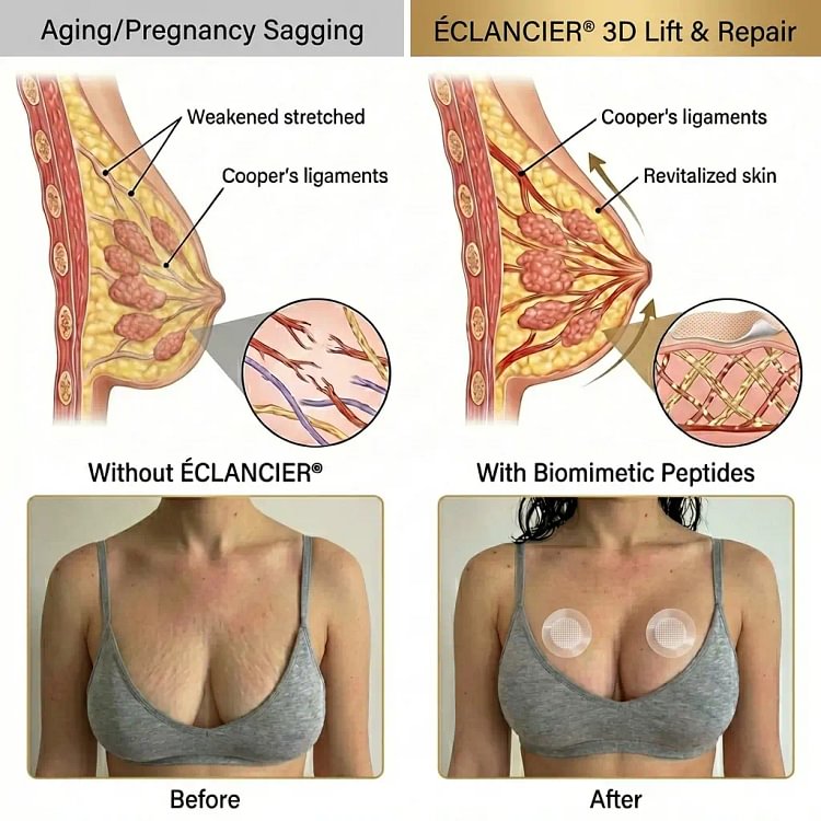 ÉCLANCIER® Targeted Breast Enhancement Advanced Nano Microneedle Patch - Image 3